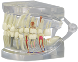 Human Teeth and Jaw Model, Clear #2861