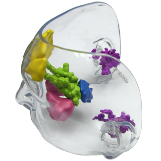 Sinus Model Over Head